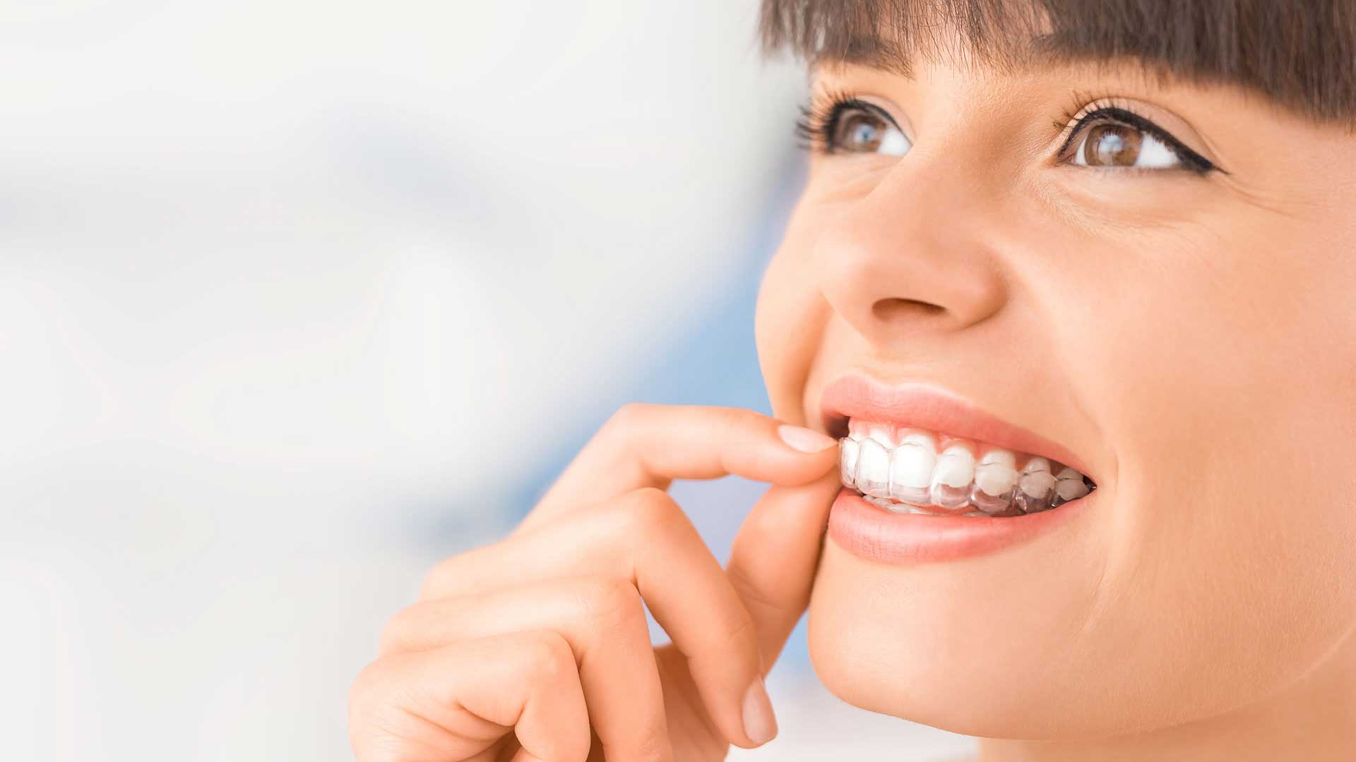 Denti: apparecchio invisibile. Per cosa si usa, benefici e consigli